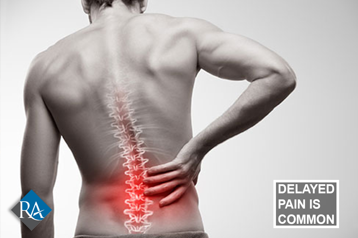 Delayed Pain After Accident